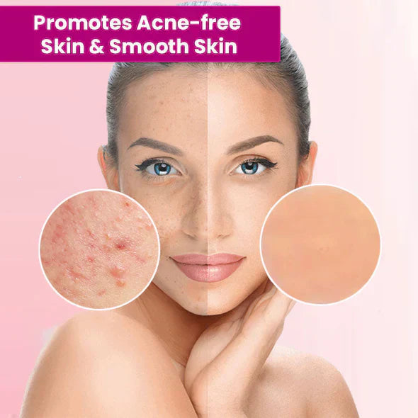 ššBUY 2 GET 3 FREEšLOVILDS⢠Tags & Moles Remover